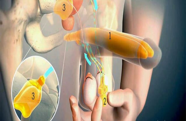 Operação de lipofiliação